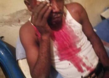 Insécurité à Kinshasa : Reagen Ngimbi de la FNJP agressé dans la commune de Ngaliema