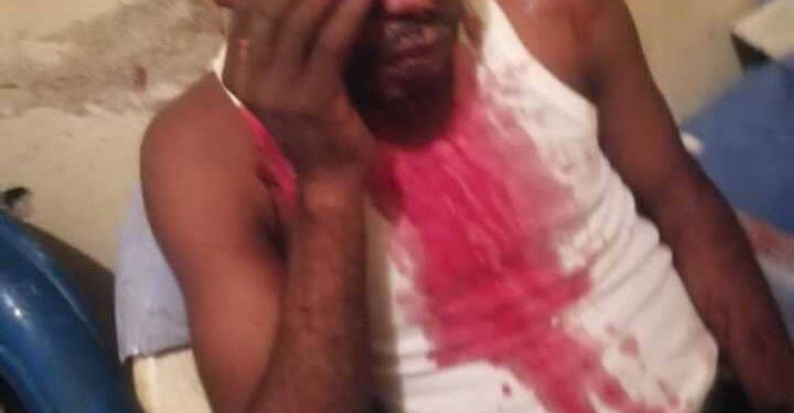 Insécurité à Kinshasa : Reagen Ngimbi de la FNJP agressé dans la commune de Ngaliema